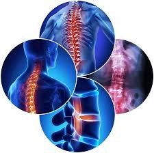 Spine Surgery in Agra
